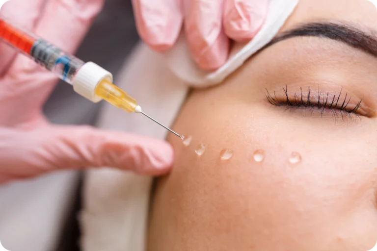 Injection d'acide hyaluronique à Écully, à Lyon